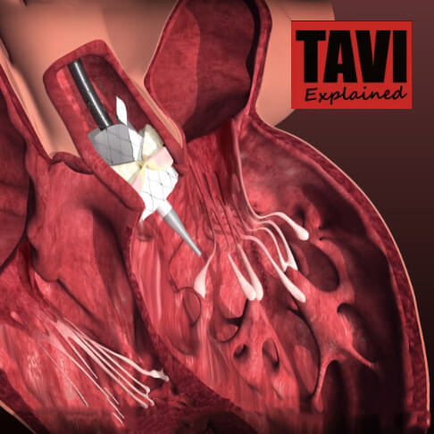 eLearning in the Healthcare